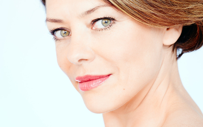 Radiesse: Lifting sin cirugía para rejuvenecer tu rostro naturalmente